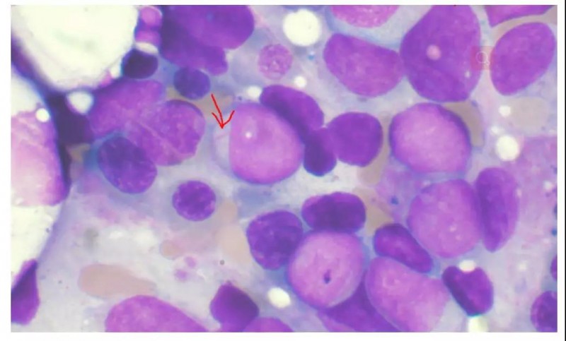 【全球24h抗癌突破】--重大突破！人造病毒刺激免疫系统消灭癌细胞！