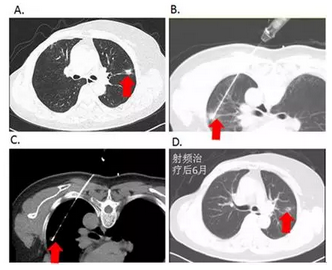 QQ图片20160426105401