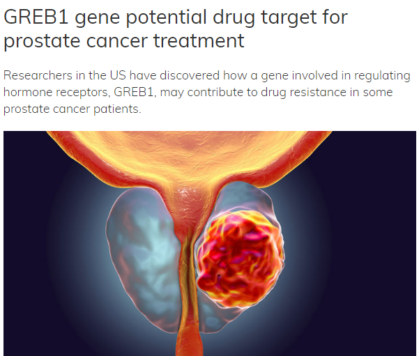 美国科学家找到解决前列腺癌患者耐药方法，靶向治疗前列腺癌的时代已经来临！