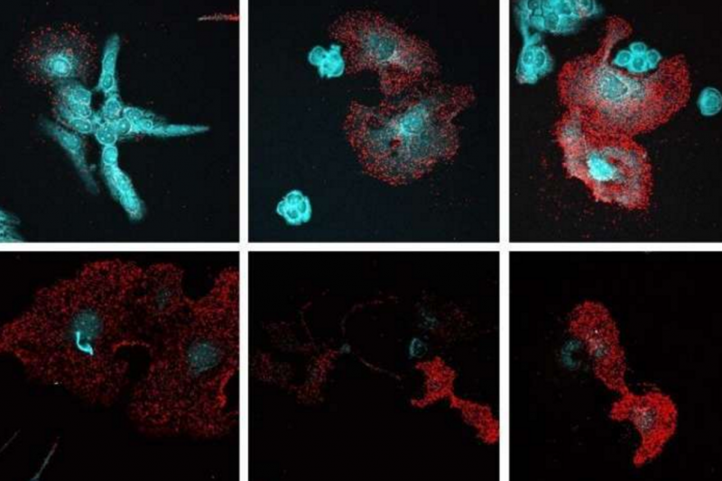 重大发现：卵巢癌不寻常的机制