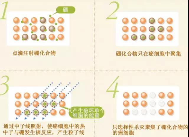 带你详细了解肿瘤划时代新疗法-BNCT・硼中子俘获疗法