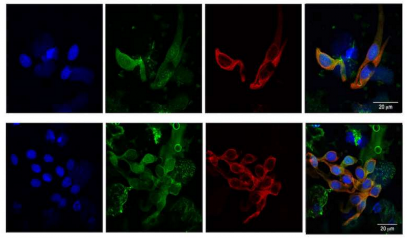 又有一种癌症疫苗被设计成功  已在犬类骨肉瘤上凸显成效