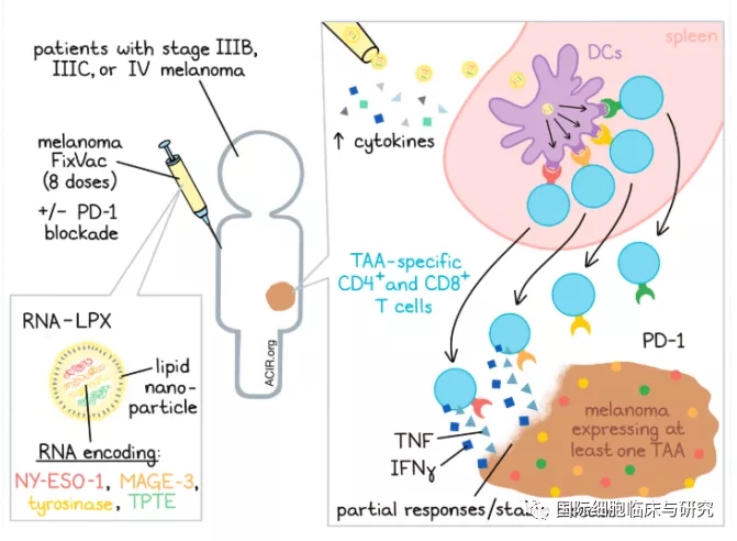 黑色素瘤疫苗,黑色素瘤RNA疫苗FixVac患者PD-1耐药后仍有效