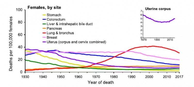 乳腺癌一定要切除整个乳房吗,螺旋断层放射治疗(TOMO Therapy放疗)更精准、更"护"心、更安全