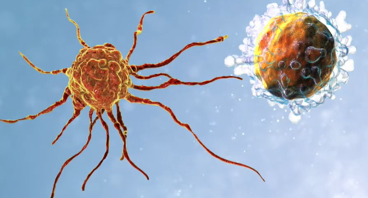 脑瘤疫苗,新型肿瘤DC疫苗AV-GBM-1让脑胶质母细胞瘤患者曙光重现