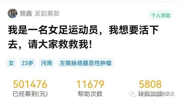 女足球员熊鑫患的眼底脉络膜恶性黑色素瘤如何治疗,可能质子治疗效果更好