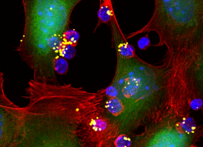 T细胞治疗小鼠实体瘤  60%肿瘤消失