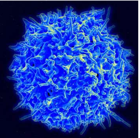 英国报道：新型CAR-T治疗有效率高达90%