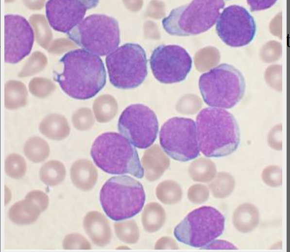 某些情况下 细菌信号能够预兆白血病