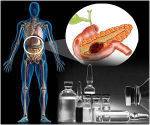 新的生物标志物将为胰腺癌精准治疗打开全新局面