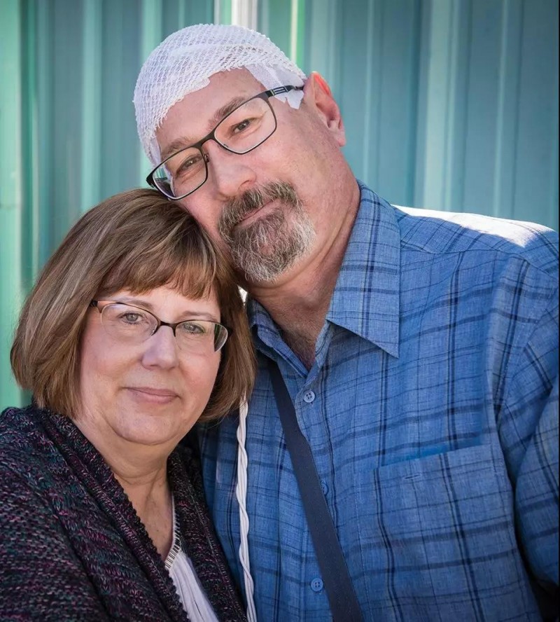 十年终于磨出一剑！这些脑瘤患者现在都健康的活着！