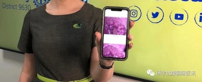 晚期结直肠癌症状有哪些,如何预防结直肠癌,美国癌症协会发布最新版结直肠癌筛查指南