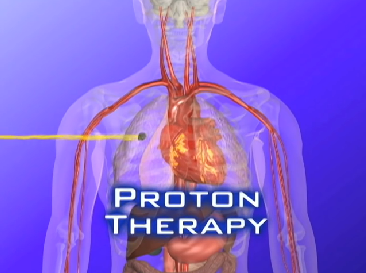 研究证实：儿童肿瘤孩子患皮肤癌风险高了30倍！这样预防更可靠（质子治疗）