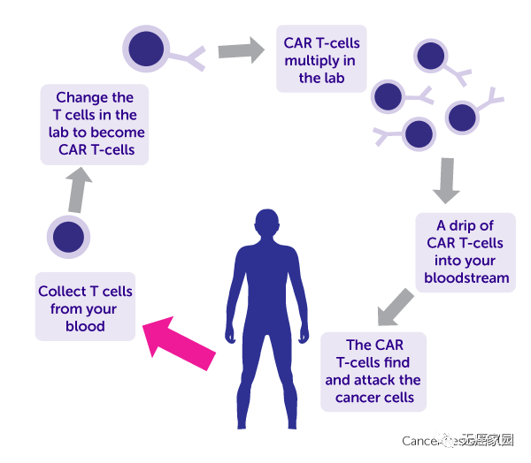 淋巴瘤CAR-T细胞免疫疗法,CAR-T细胞免疫治疗,CAR-T临床试验