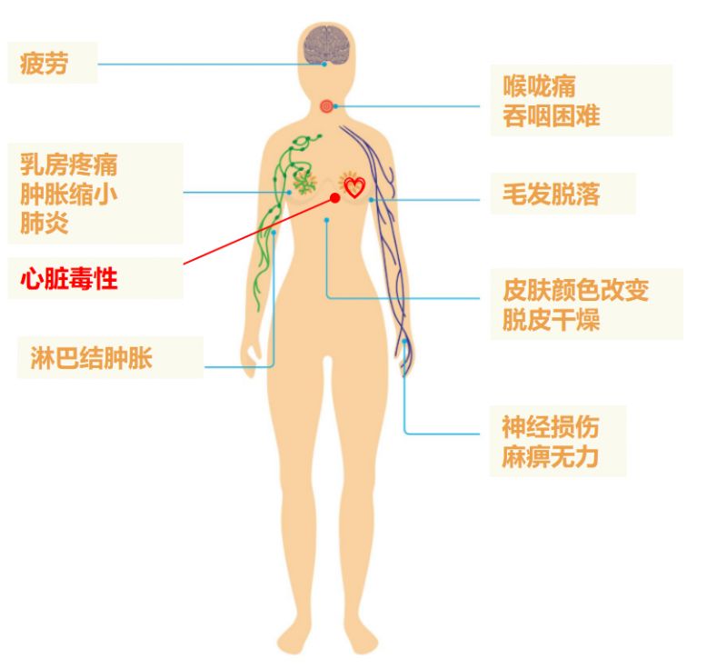 乳腺癌放疗保护心脏“难”，质子治疗帮你力挽狂澜