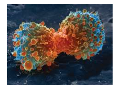 这一免疫组合疗法对肾癌很有效