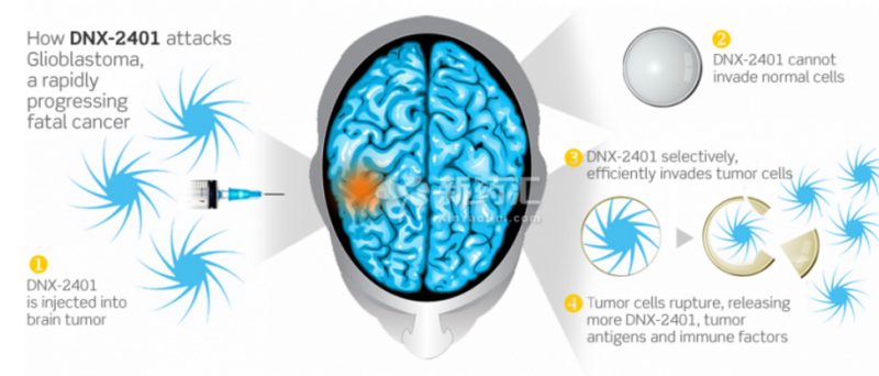 脑瘤延长生存期超过3年  得益于这种不寻常疗法