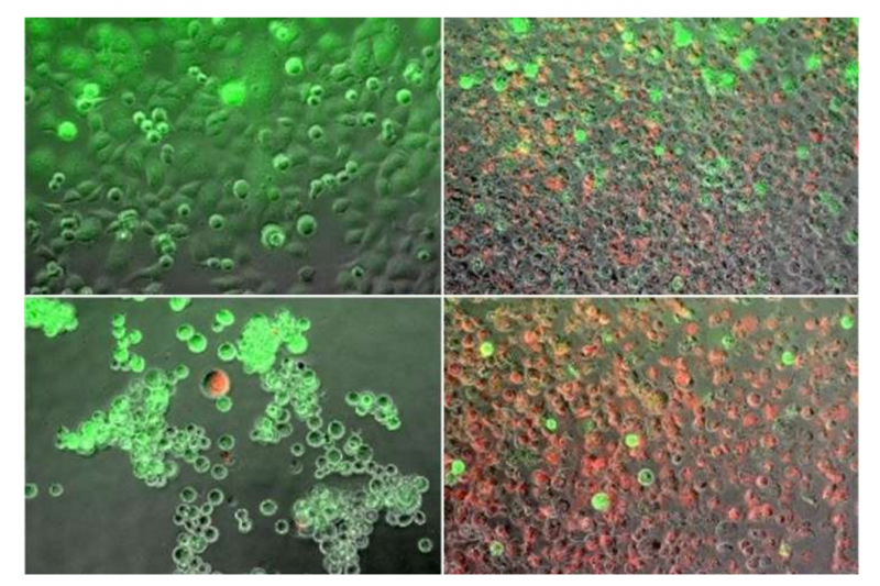 可喜可贺|这种手术方法有望治疗癌王-胰腺癌