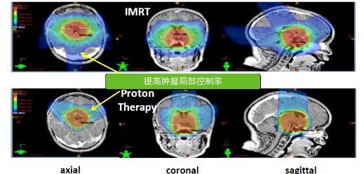 【儿童肿瘤首选】美国约翰霍普金斯质子中心将于2019年开业 ，接受儿童