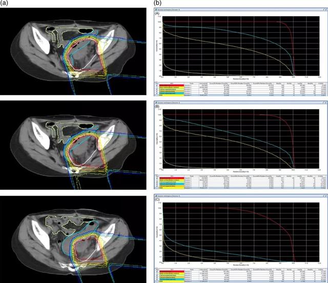 卵巢癌质子治疗,卵巢癌质子治疗优势,卵巢癌质子治疗价格费用多少钱