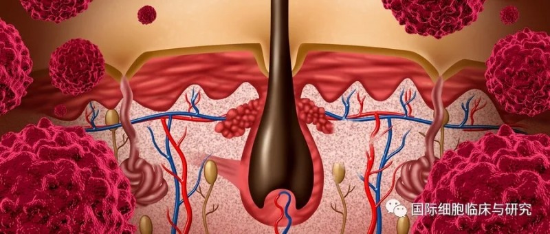 癌症肿瘤细胞免疫疗法治疗的原理,黑色素瘤免疫治疗方案