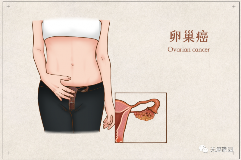 卵巢癌、子宫内膜癌、宫颈癌三大妇科肿瘤预防如何做,妇科肿瘤筛查很重要,如果得了妇科肿瘤怎么治疗