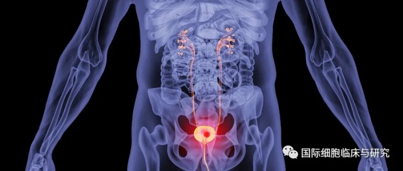 3种常见膀胱癌的治疗方法和6种FDA批准的膀胱癌免疫治疗方案