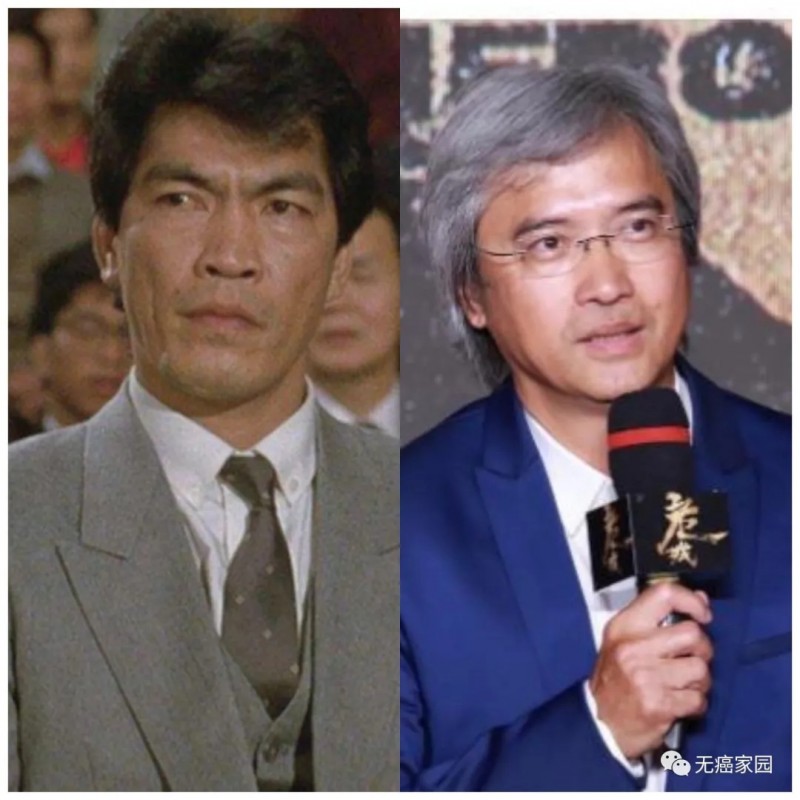 鼻咽癌放疗,鼻咽癌放射治疗,鼻咽癌质子重离子治疗患者两年总生存率高达83.7%