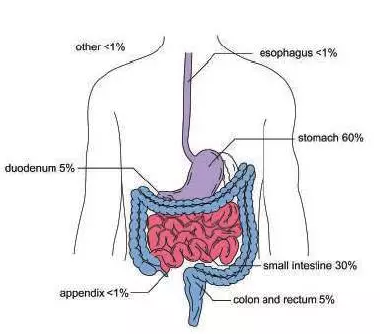 胃肠间质瘤病理报告为何如此重要？