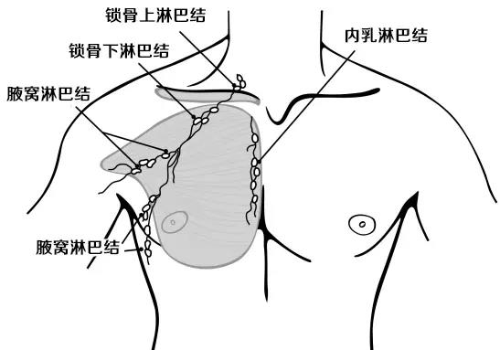 乳腺癌放疗,乳腺癌术后放疗注意事项