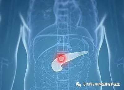 质子治疗胰腺癌成功案例分享