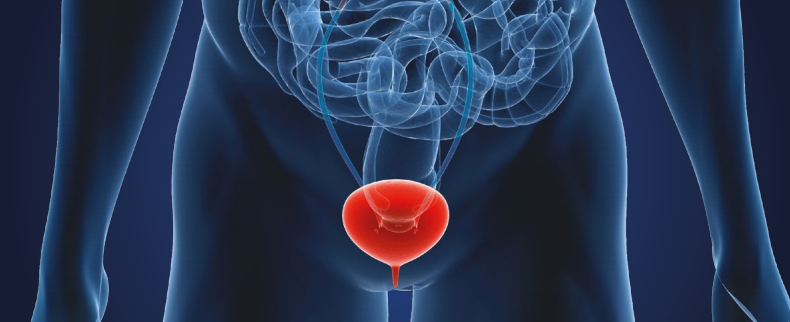 美国公布 膀胱癌的饮食、营养、运动建议（第三版癌症预防报告）