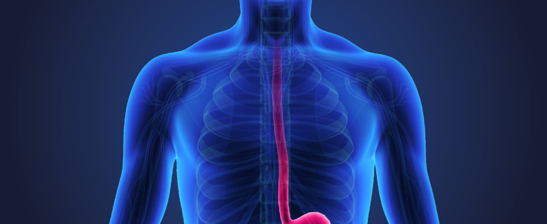 美国公布  食道癌的饮食、营养、运动建议（第三版癌症预防报告）