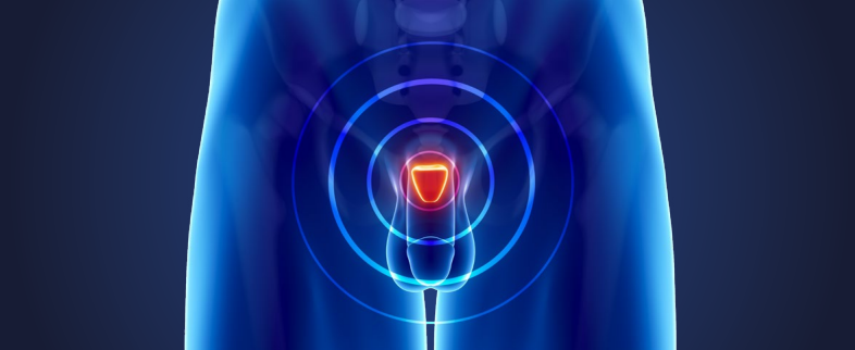 美国公布  前列腺癌的饮食、营养、运动建议（第三版癌症预防报告）