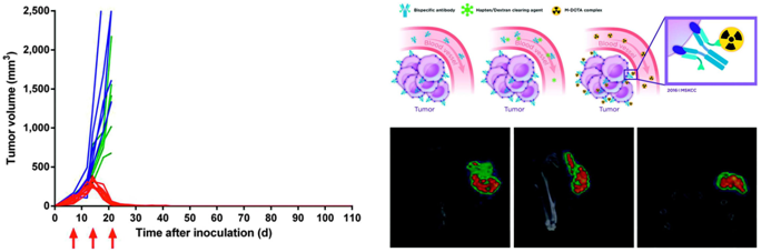 三步搞定结肠直肠癌
