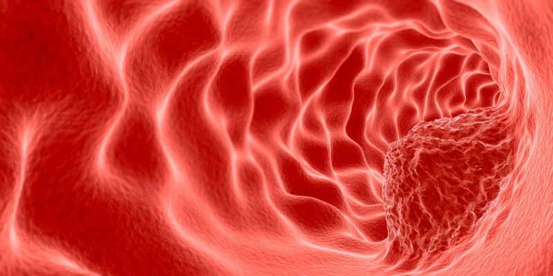 前列腺癌难无进展生存，尽早考虑德国治疗