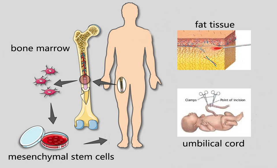 干细胞输注途径