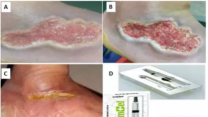 这些年，干细胞给予了他们新生！