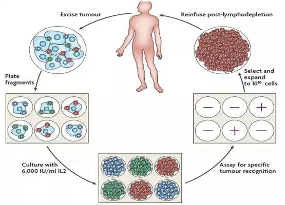 肿瘤浸润淋巴细胞TILS,TIL疗法,TIL细胞治疗的最新研究进展盘点(图12) TILs疗法的治疗过程
