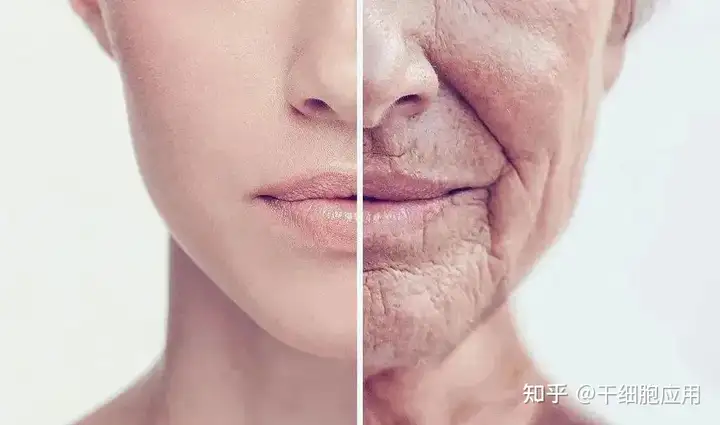 干细胞帮助肌肤恢复年轻态，有效抗衰老